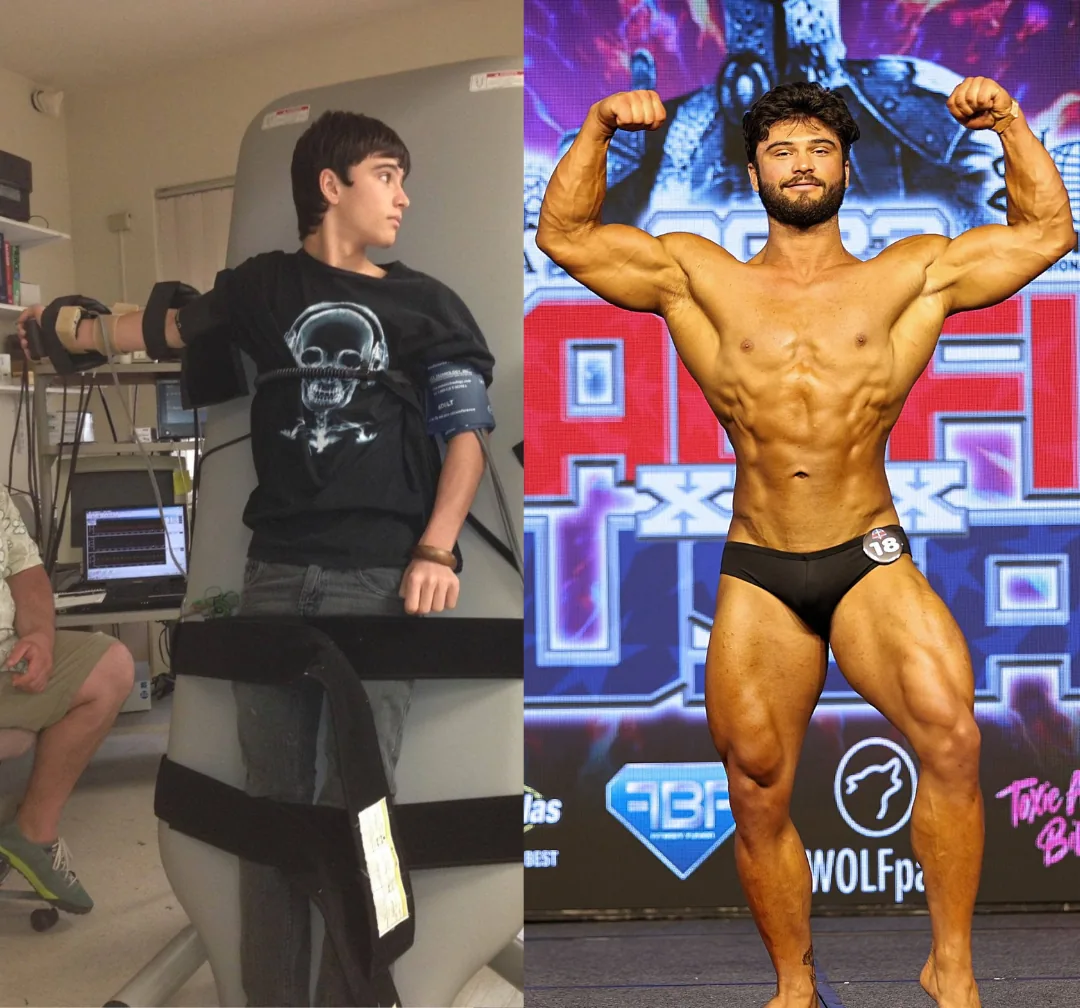 Aaron's personal journey: from managing chronic illness to competing on the bodybuilding stage